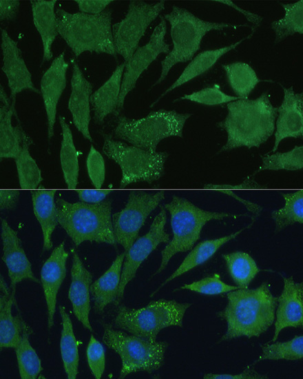 Immunofluorescence analysis of L929 cells using CGRP Polyclonal Antibody at dilution of 1:100. Blue: DAPI for nuclear staining.