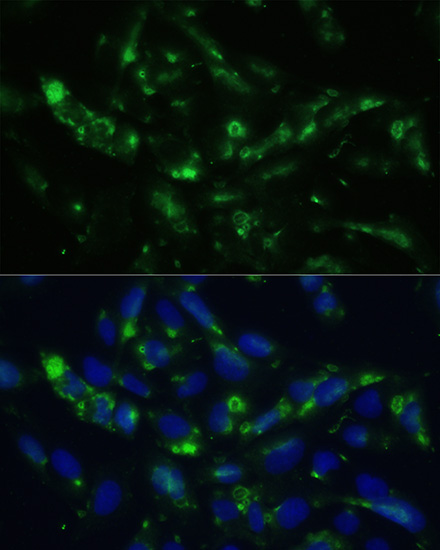 Immunofluorescence analysis of U2OS cells using CGRP Polyclonal Antibody at dilution of 1:100. Blue: DAPI for nuclear staining.