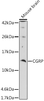 Western blot analysis of extracts of Mouse brain using CGRP Polyclonal Antibody at 1:1000 dilution.