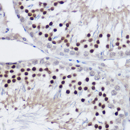 Immunohistochemistry of paraffin-embedded rat testis using PLZF Polyclonal Antibody at dilution of 1:100 (40x lens).Perform high pressure antigen retrieval with 10 mM citrate buffer pH 6.0 before commencing with IHC staining protocol.