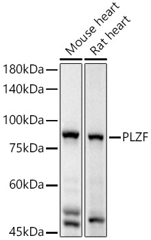 Western blot analysis of extracts of various cell lines using PLZF Polyclonal Antibody at 1:2000 dilution.