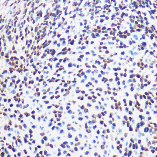 Immunohistochemistry of paraffin-embedded mouse embryos using [KO Validated] SOX2 Polyclonal Antibody at dilution of 1:100 (40x lens).Perform microwave antigen retrieval with 10 mM Tris/EDTA buffer pH 9.0 before commencing with IHC staining protocol.