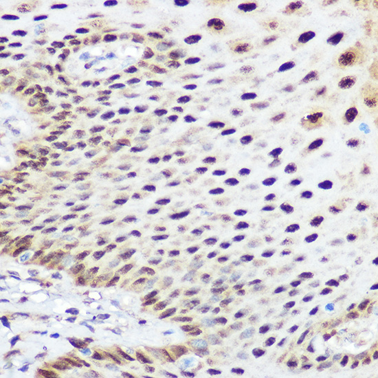 Immunohistochemistry of paraffin-embedded human esophageal using [KO Validated] SOX2 Polyclonal Antibody at dilution of 1:100 (40x lens).Perform microwave antigen retrieval with 10 mM Tris/EDTA buffer pH 9.0 before commencing with IHC staining protocol.