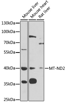 Western blot analysis of extracts of various cell lines using MT-ND2 Polyclonal Antibody at 1:1000 dilution.