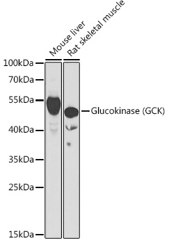 Western blot analysis of extracts of various cell lines using Glucokinase Polyclonal Antibody at 1:1000 dilution.