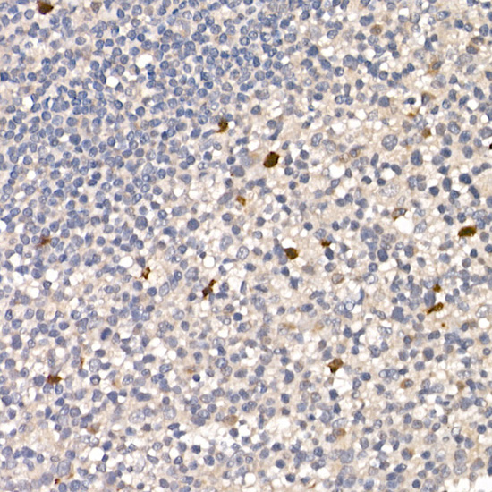 Immunohistochemistry of paraffin-embedded human tonsil using NUR77 Polyclonal Antibody at dilution of 1:100 (40x lens).Perform high pressure antigen retrieval with 10 mM citrate buffer pH 6.0 before commencing with IHC staining protocol.