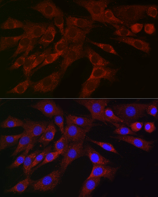 Immunofluorescence analysis of NIH/3T3 cells using PLK2 Polyclonal Antibody at dilution of 1:100 (40x lens). Blue: DAPI for nuclear staining.