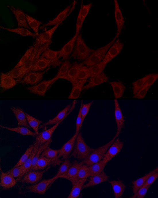 Immunofluorescence analysis of PC-12 cells using PLK2 Polyclonal Antibody at dilution of 1:100 (40x lens). Blue: DAPI for nuclear staining.