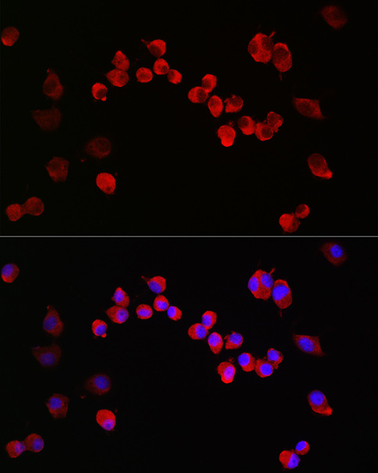 Immunofluorescence analysis of Neuro-2a cells using NMDAR1 Polyclonal Antibody at dilution of 1:200 (40x lens). Blue: DAPI for nuclear staining.