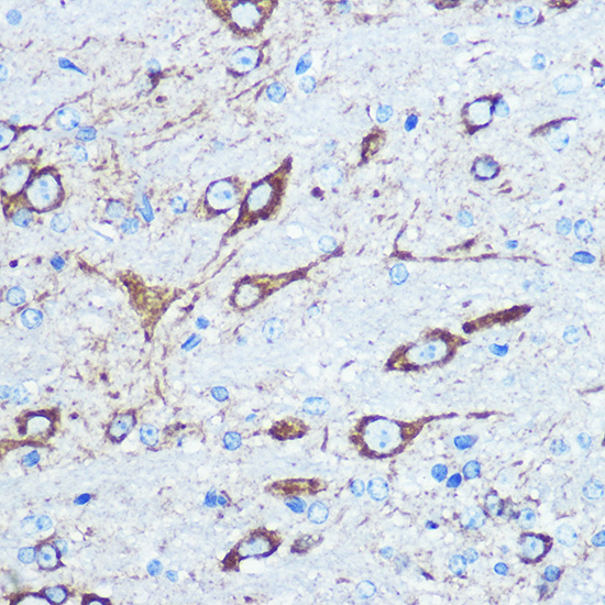 Immunohistochemistry of paraffin-embedded mouse brain using NMDAR1 Polyclonal Antibody at dilution of 100 (40x lens).Perform microwave antigen retrieval with 10 mM PBS buffer pH 7.2 before commencing with IHC staining protocol.