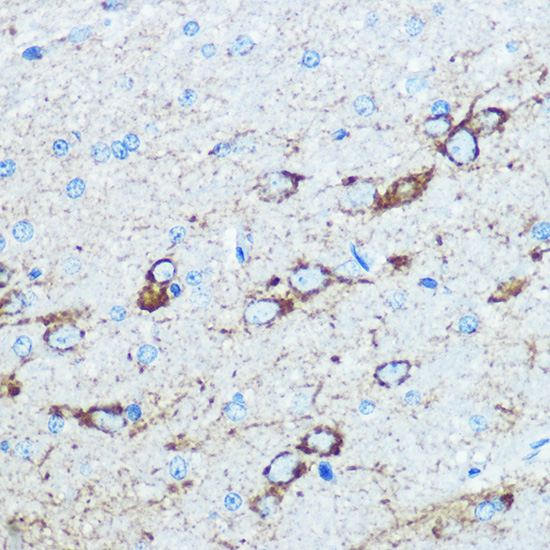 Immunohistochemistry of paraffin-embedded rat brain using NMDAR1 Polyclonal Antibody at dilution of 100 (40x lens).Perform microwave antigen retrieval with 10 mM PBS buffer pH 7.2 before commencing with IHC staining protocol.