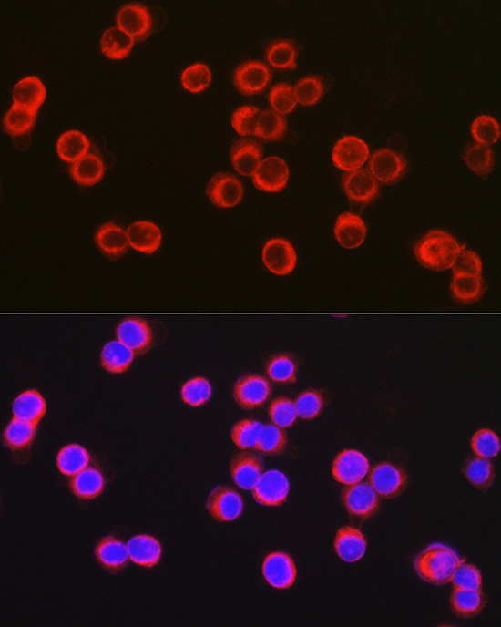 Immunofluorescence analysis of HT-29 cells using CFTR Polyclonal Antibody at dilution of 1:100 (40x lens). Blue: DAPI for nuclear staining.