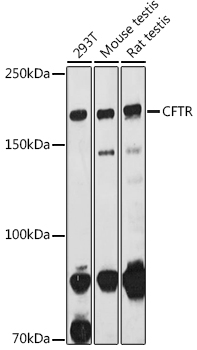 Western blot analysis of extracts of various cell lines using CFTR Polyclonal Antibody at 1:1000 dilution.