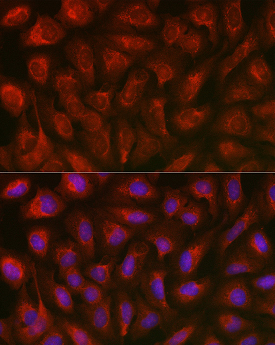 Immunofluorescence analysis of U2OS cells using TXNIP Polyclonal Antibody at dilution of 1:100. Blue: DAPI for nuclear staining.