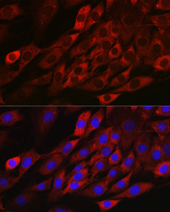 Immunofluorescence analysis of NIH/3T3 cells using TXNIP Polyclonal Antibody at dilution of 1:100. Blue: DAPI for nuclear staining.