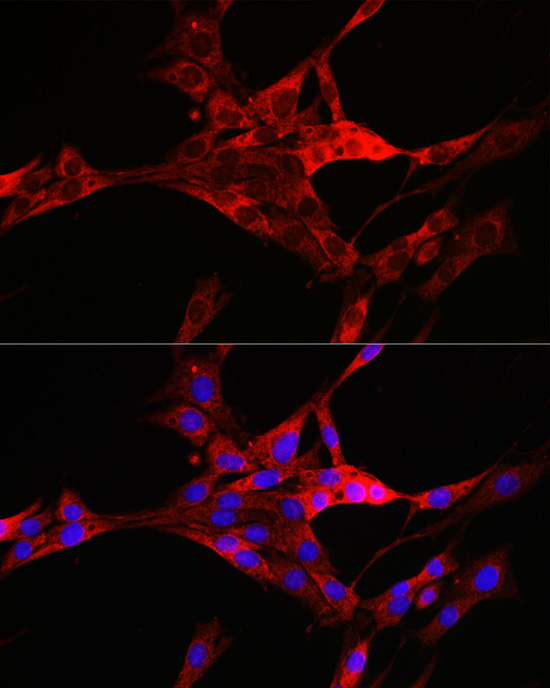 Immunofluorescence analysis of PC-12 cells using TXNIP Polyclonal Antibody at dilution of 1:100. Blue: DAPI for nuclear staining.