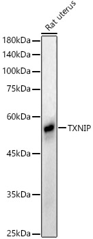 Western blot analysis of extracts of Rat uterus using TXNIP Polyclonal Antibody at 1:1000 dilution.