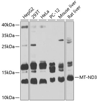 Western blot analysis of extracts of various cell lines using MT-ND3 Polyclonal Antibody at 1:1000 dilution.