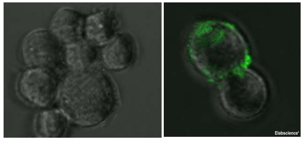 Immunofluorescence analysis of 293T cells by overexpressed SARS-CoV Spike Protein (Right) or not (Left) using SARS-CoV Spike Monoclonal Antibody at dilution of 1:50.