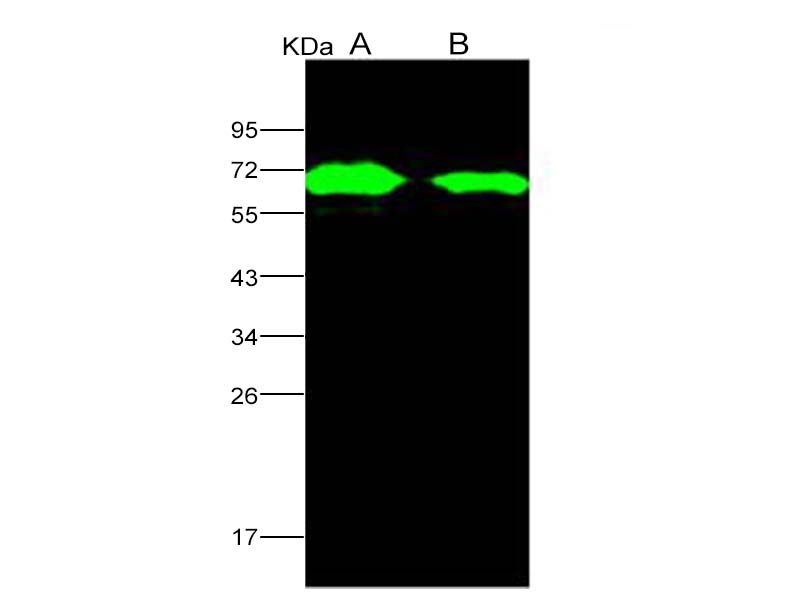 Western Blot analysis of Recombinant AcmNPV Envelope glycoprotein gp64(His Tag)(PKSV030118 with 50ng and 10ng) using Anti-AcmNPV Envelope glycoprotein gp64/AcmNPV-gp64 Polyclonal Antibody at dilution of 1:1000.