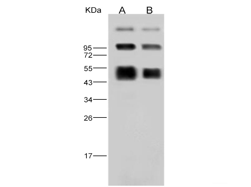 Western Blot analysis of Recombinant DENV (type 2, strain New Guinea C) NS1 Protein (His Tag)(PKSV030124 with 30ng and 10ng) using Anti-Dengue virus DENV-2(Strain New Guinea C) NS1 Polyclonal Antibody at dilution of 1:2000.