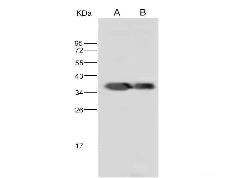 Western Blot analysis of Recombinant DENV-2 (strain New Guinea C) NS5 (methyltransferase domain) / Nonstructural protein 5 Protein (His Tag)(PKSV030133 with 5ng and 1ng) using Anti-Dengue virus DENV-2(strain New Guinea C) NS5(methyltransferase domain) /Nonstructural protein 5 Polyclonal Antibody at dilution of 1:10000.