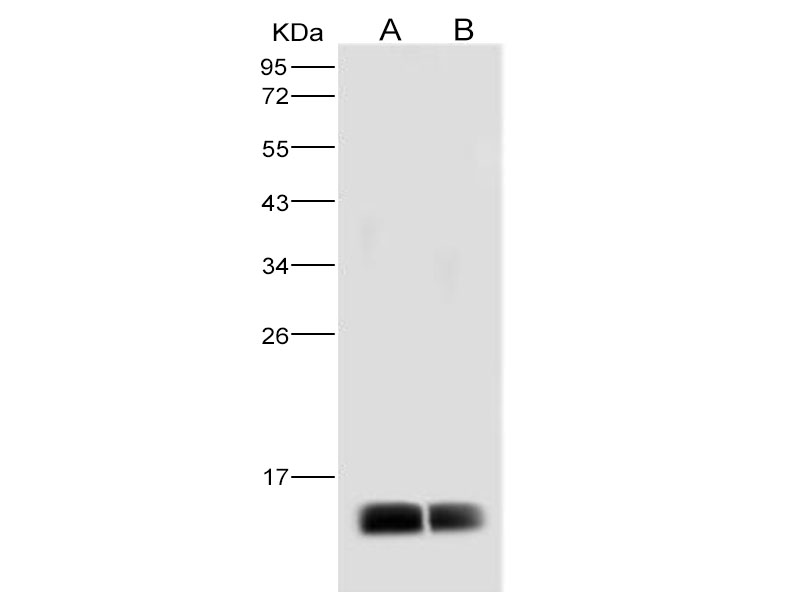 Western Blot analysis of Recombinant DENV (type 2, strain New Guinea C/PUO-218 hybrid) E / Envelope Protein (Domain III, His Tag)(PKSV030125 with 30ng and 10ng) using Anti-Dengue virus DENV-2(Strain New Guinea C/PUO-218 hybrid) E/Envelope Protein Polyclonal Antibody at dilution of 1:2000.