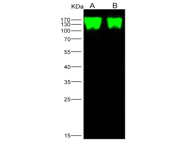 Western Blot analysis of Recombinant Epstein-Barr virus (Herpesvirus 4) EBV Glycoprotein gp350 / EBV GP350 Protein (His Tag)(PKSV030172 with 5ng and 1ng) using Anti-Epstein-Barr virus(Herpesvirus 4) EBV Glycoprotein gp350/EBV GP350 Polyclonal Antibody at dilution of 1:1000.