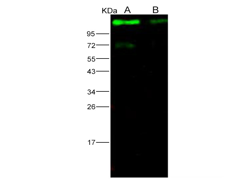 Western Blot analysis of Recombinant EBOV (Subtype Sudan, strain Gulu) Glycoprotein / GP1 (mucin domain deleted) Protein (His Tag)(PKSV030141 with 20ng and 5ng) using Anti-Ebola virus EBOV(Subtype Sudan, strain Gulu) Glycoprotein/GP1(mucin domain deleted) Monoclonal Antibody at dilution of 1:1000.