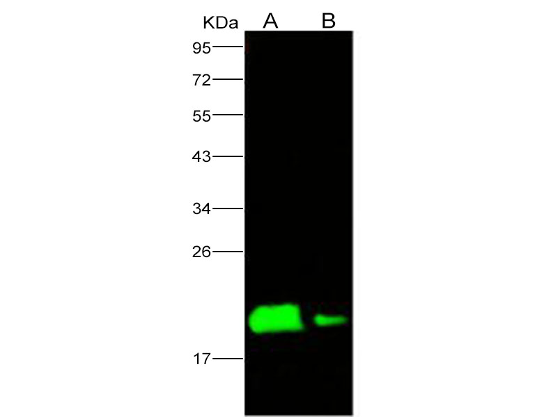 Western Blot analysis of Recombinant EBOV (subtype Zaire, strain H.sapiens-wt/GIN/2014/Kissidougou-C15) Nucleoprotein / NP Protein (His Tag)(PKSV030159 with 50ng and 10ng) using Anti-Ebola virus EBOV(subtype Zaire, strain H.sapiens-wt/GIN/2014/Kissidougou-C15) Nucleoprotein/NP Polyclonal Antibody at dilution of 1:1000.