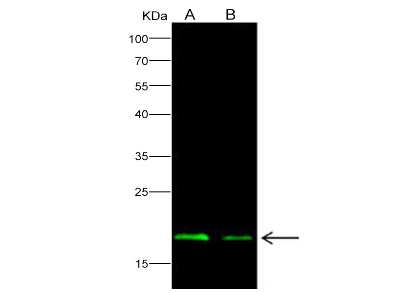 Western Blot analysis of Recombinant EBOV (subtype Zaire, strain H.sapiens-wt/GIN/2014/Kissidougou-C15) Matrix protein VP40 Protein (His Tag)(PKSV030158 with 50ng and 20ng) using Anti-Ebola virus EBOV(subtype Zaire, strain H.sapiens-wt/GIN/2014/Kissidougou-C15) Nucleoprotein / NP Polyclonal Antibody at dilution of 1:1000.