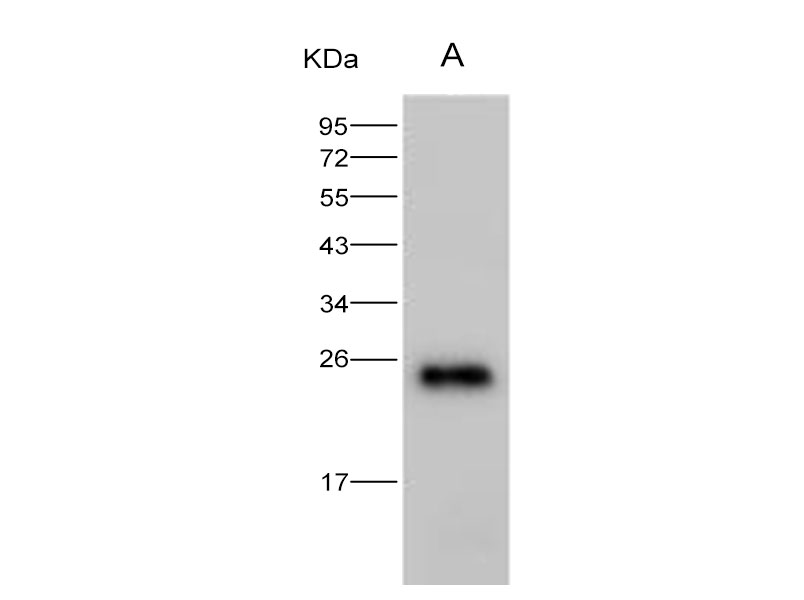 Western Blot analysis of Recombinant HIV-1 p24 Protein (group M, subtype B, strain 92418) (His Tag)(PKSV030191 with 30ng) using Anti-HIV-1 p24 Protein(group M, subtype B, strain 92418) Polyclonal Antibody at dilution of 1:2000.