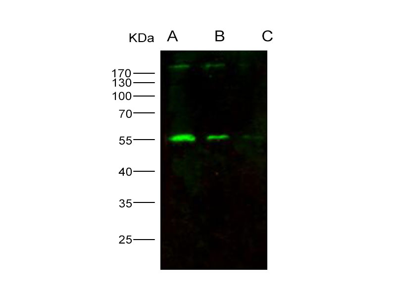 Western Blot analysis of Recombinant HIV-p51 / RT-p51 (group M, subtype B (isolate HXB2) Gag-Pol polyprotein Protein (His Tag)(PKSV030198 with 20ng, 5ng and 1ng ) using Anti-HIV-p51/RT-p51(group M, subtype B(isolate HXB2) Gag-Pol polyprotein Polyclonal Antibody at dilution of 1:1000.
