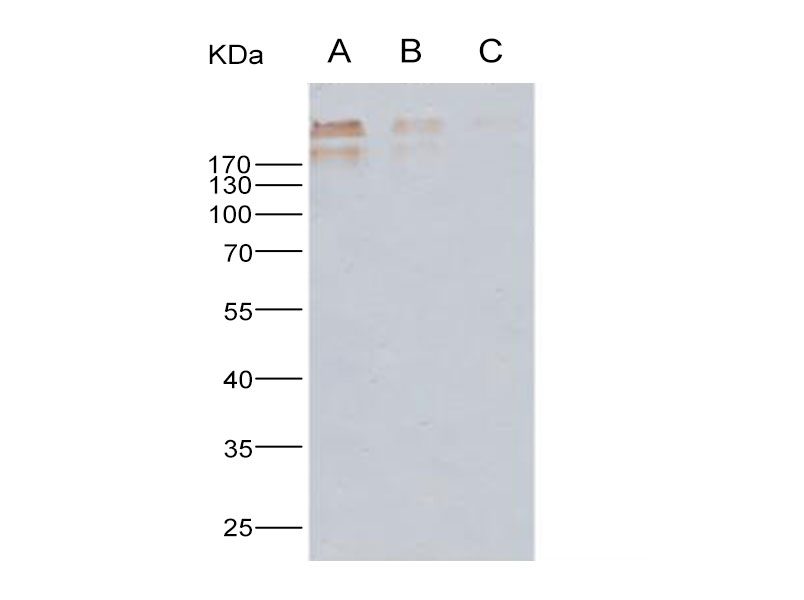 Western Blot analysis of Recombinant Human cytomegalovirus (HCMV) Glycoprotein B / gB Protein (His Tag)(PKSV030208 with 100ng, 20ng and 4ng ) using Anti-Human cytomegalovirus(HCMV) Glycoprotein B/gB Monoclonal Antibody at dilution of 1:1000.