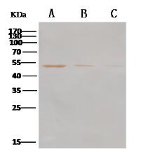 Western Blot analysis of Recombinant MERS-CoV Nucleoprotein / NP protein (His Tag)(PKSV030235 with 500ng, 200ng and 100ng ) using Anti-MERS-CoV Nucleocapsid Protein Polyclonal Antibody at dilution of 1:1000.