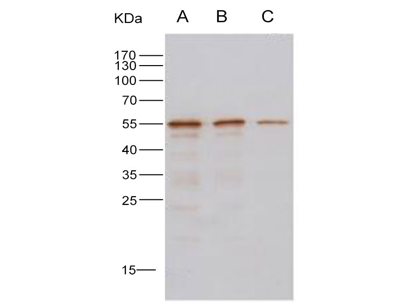 Western Blot analysis of Recombinant MERS-CoV Nucleoprotein / NP protein (His Tag)(PKSV030235 with 10ng, 5ng and 2ng ) using Anti-MERS-CoV Nucleocapsid Protein Polyclonal Antibody at dilution of 1:1000.