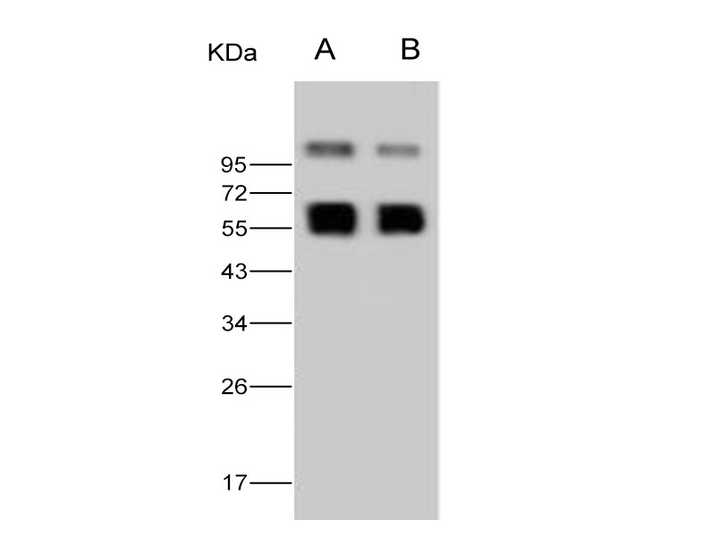 Western Blot analysis of Recombinant WNV (lineage 1, strain NY99) NS1 Protein (His Tag)(PKSV030261 with 30ng and 10ng) using Anti-West Nile Virus(WNV)(lineage 1, strain NY99) NS1 Polyclonal Antibody at dilution of 1:2000.