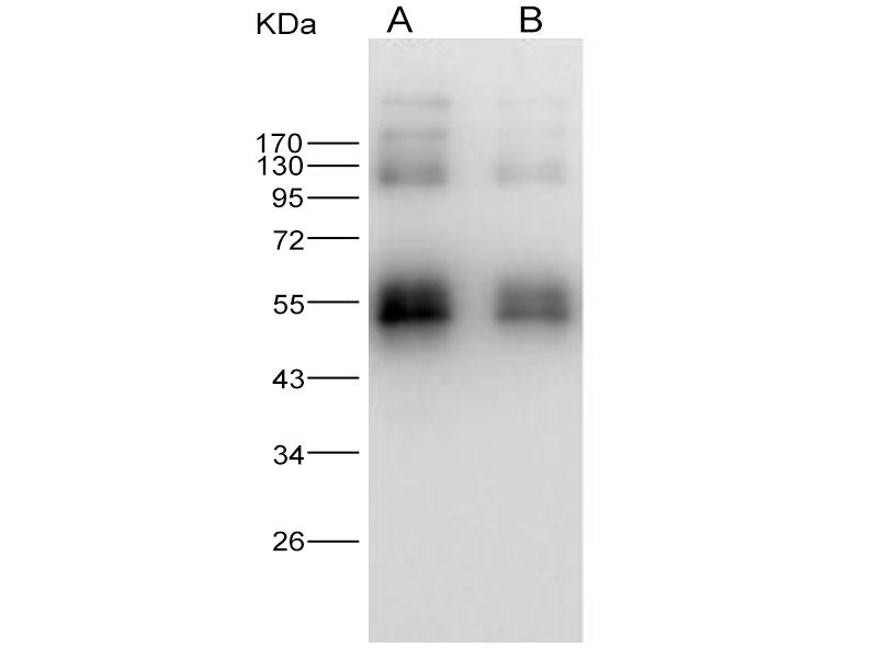 Western Blot analysis of Recombinant ZIKV (strain Zika SPH2015) NS1 protein (N-His Tag)(PKSV030272 with 30ng and 10ng) using Anti-Zika virus(ZIKV)(strain Zika SPH2015) ZIKV-NS1 Monoclonal Antibody at dilution of 1:1000.