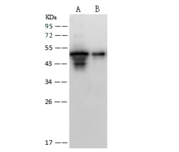 Western Blot analysis of Recombinant SARS-CoVNucleoprotein/NPProtein(PKSV030248 with 30ng and 5ng) using Anti-SARS-CoV Nucleoprotein / NP Polyclonal Antibody at dilution of 1:2000.