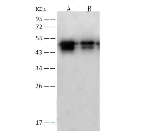 Western Blot analysis of Recombinant SARS-CoVNucleoprotein/NPProtein(PKSV030248 with 30ng and 5ng) using Anti-SARS-CoV Nucleoprotein / NP Monoclonal Antibody at dilution of 1:2000.
