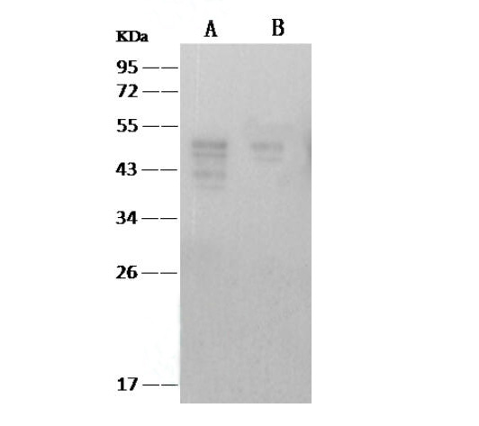 Western Blot analysis of Recombinant SARS-CoVNucleoprotein/NPProtein(PKSV030248 with 50ng and 15ng) using Anti-SARS-CoV Nucleoprotein / NP Monoclonal Antibody at dilution of 1:2000.
