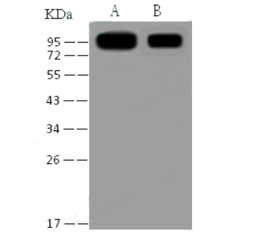 Western Blot analysis of Recombinant SARS-CoV S1 Protein (His Tag)(PKSV030101 with 30ng and 5ng) using Anti-SARS-CoV Spike S1 Monoclonal Antibody at dilution of 1:1000.