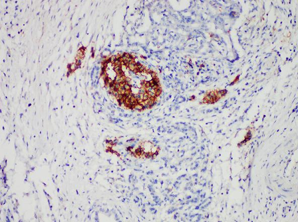Immunohistochemistry of paraffinembedded Human pancreatic tissue with CD99 Monoclonal Antibody(Antigen repaired by EDTA).