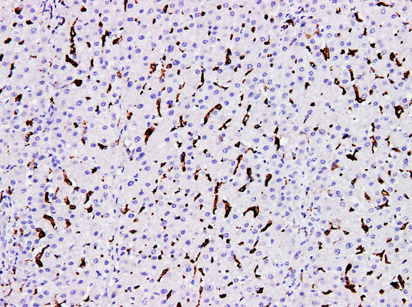 Immunohistochemistry of paraffinembedded Human liver tissue with CD163 Monoclonal Antibody(Antigen repaired by EDTA).
