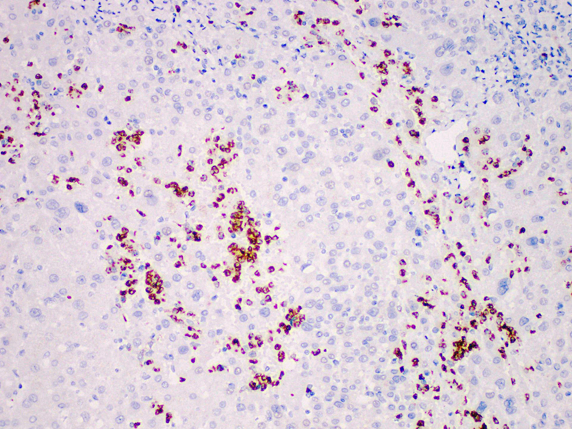 Immunohistochemistry of paraffinembedded Human liver tissue with MPO Monoclonal Antibody(Antigen repaired by EDTA).