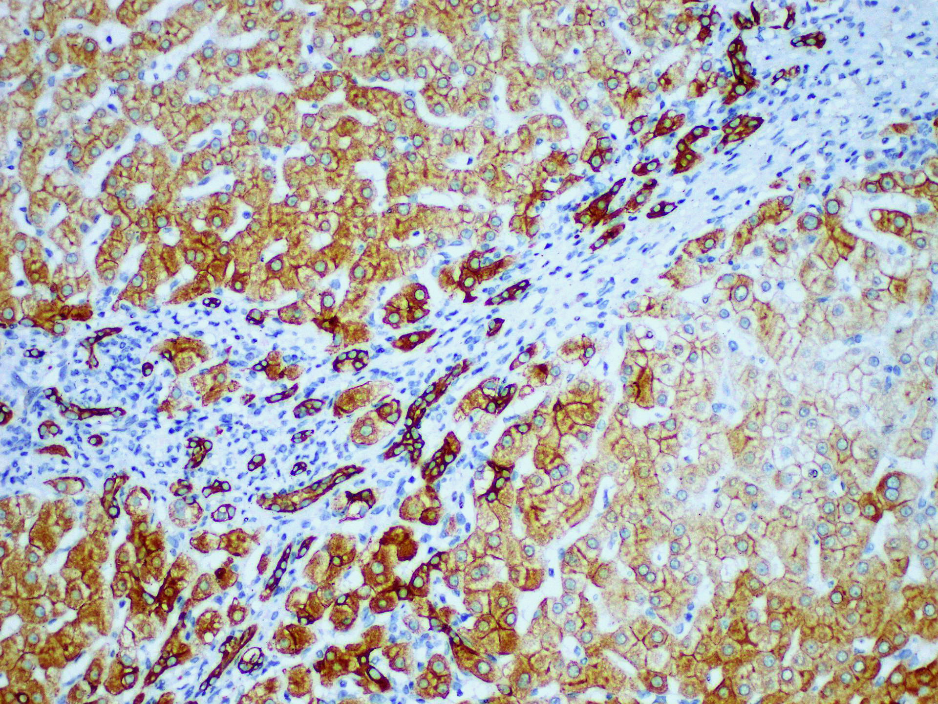 Immunohistochemistry of paraffinembedded Human liver tissue with CK8/18 Monoclonal Antibody(Antigen repaired by EDTA).