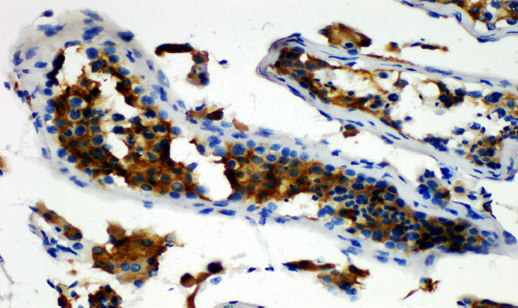 Immunohistochemistry of paraffinembedded Human testicular tissue with Inhibin,alpha Monoclonal Antibody(Antigen repaired by EDTA).