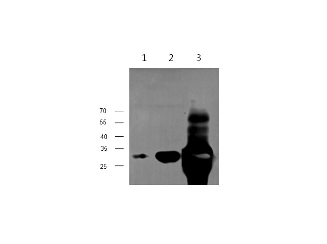 Western blot with TNNI3 Polyclonal antibody at dilution of 1:1000.lane 1:C2C12 whole cell lysate, lane 2:Mouse Heart, lane 3:Rat Heart