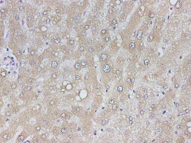 Immunohistochemistry of paraffin-embedded Human liver using TF Polyclonal Antibody at dilution of 1:2400