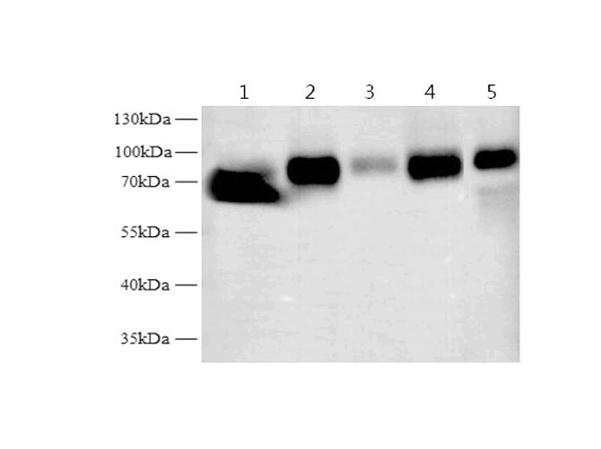 Western blot with Tf Polyclonal antibody at dilution of 1:10000.lane 1:Mouse testis,lane 2:Mouse kidney,lane 3:Mouse liver,lane 4:Rat testis,lane 5:Rat liver